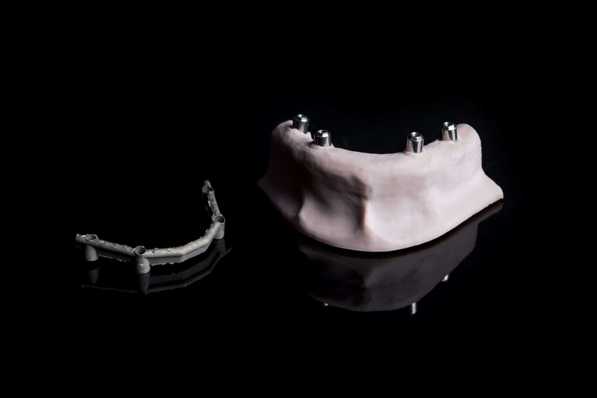 muestras microlay 7 – Microlay Dental 3D Printers