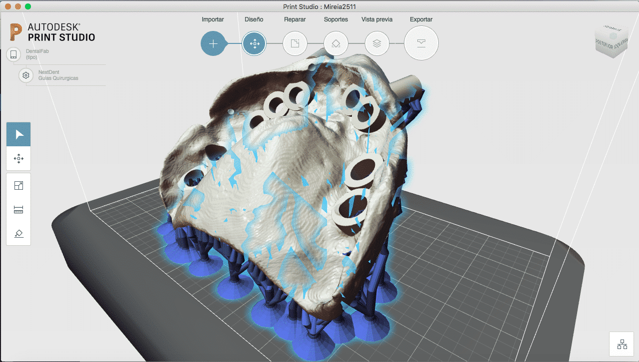How Autodesk Print Studio patch for DentalFab 1/1b – Microlay Dental 3D Printers
