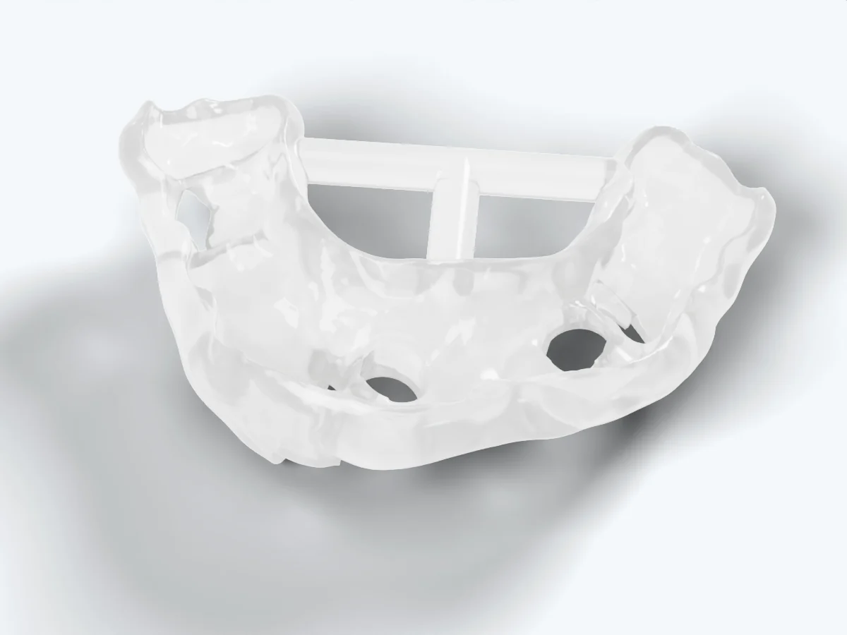 Surgical guides